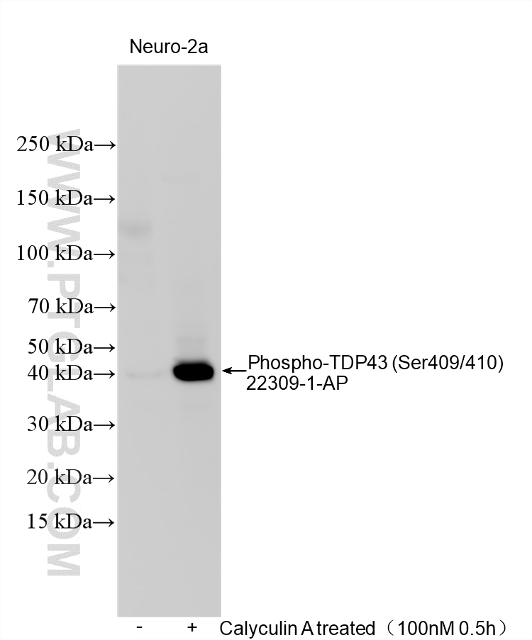 WB analysis using 22309-1-AP Western Blot (WB) analysis of various lysates using Phospho-TDP43 (Ser409/410) Polyclonal antibody (22309-1-AP)
