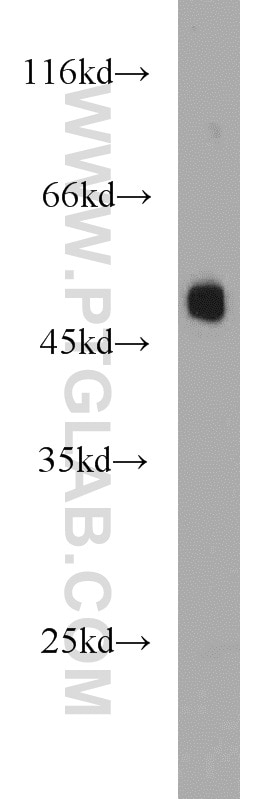 Phospho-TDP43 (Ser409/410) Polyclonal antibody