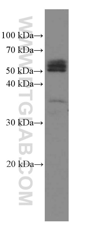 Western Blot (WB) analysis of human placenta tissue using Phospho-TDP43 (Ser409/410) Monoclonal antibody (66318-1-Ig)