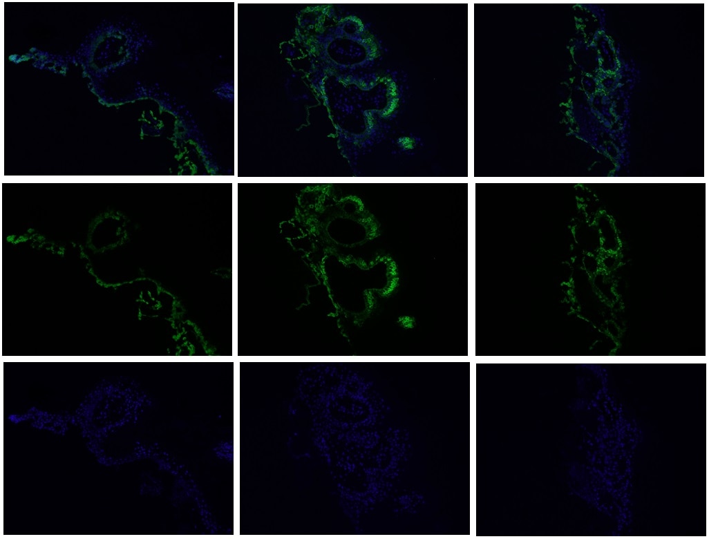 Phospho-AKT (Tyr315) Monoclonal antibody