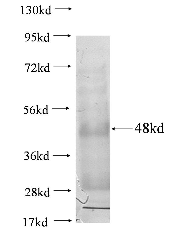 ppa2 fusion protein Ag0750 SDS-PAGE
