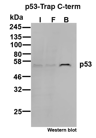 p53-C-term-Trap Agarose for Immunoprecipitation of p53.I: Input, FT: Flow-through, B: Bound.
