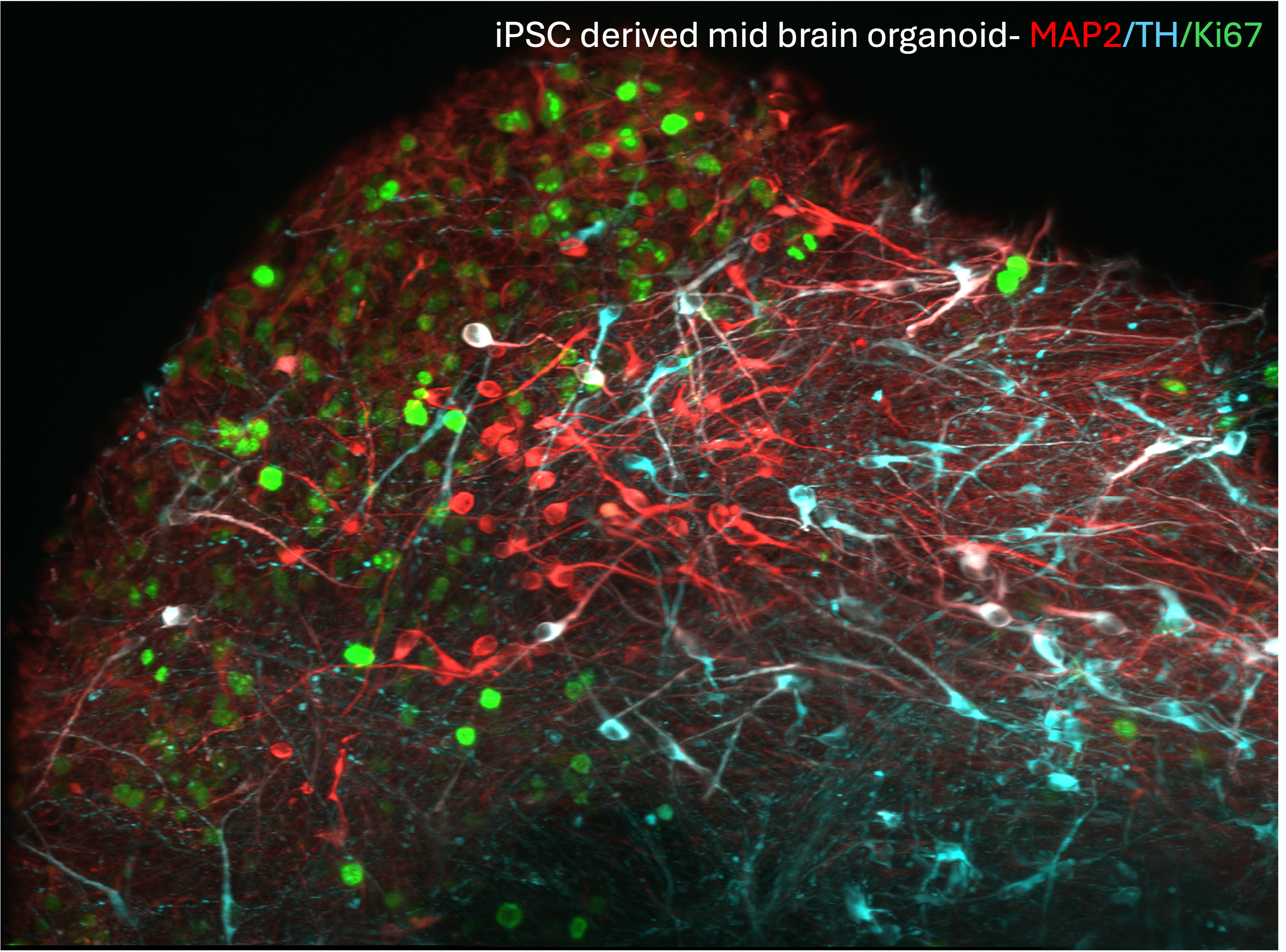 iPSC-derived Human Midbrain Organoids Cultured using Recombinant Human Noggin, Sonic Hedgehog (SHH), FGF-8B, GDNF and BDNF). iPSCs differentiated to Midbrain organoids using HumanKine® recombinant human Noggin (HZ-1118), HumanKine® recombinant human SHH (HZ-1306), HumanKine® recombinant human FGF-8b (HZ-1103), HumanKine® recombinant human GDNF ( HZ-1311), HumanKine® recombinant human BDNF ( HZ-1335) were fixed and permeabilized for detection of endogenous MAP2 (red), Ki67(green) and Tyrosine hydroxylase(Cyan) using primary antibodies labelled using FlexAble antibody labeling kits( KFA502- FlexAble 2.0 CoraLite® Plus 555 Antibody Labeling Kit for Rabbit IgG, FlexAble 2.0 CoraLite® Plus 647 Antibody Labeling Kit for Rabbit IgG and FlexAble 2.0 CoraLite® Plus 488 Antibody Labeling Kit for Rabbit IgG) iPSC-derived Human Midbrain Organoids Cultured using Recombinant Human Noggin, Sonic Hedgehog (SHH), FGF-8B, GDNF and BDNF). iPSCs differentiated to Midbrain organoids using HumanKine® recombinant human Noggin (HZ-1118), HumanKine® recombinant human SHH (HZ-1306), HumanKine® recombinant human FGF-8b (HZ-1103), HumanKine® recombinant human GDNF ( HZ-1311), HumanKine® recombinant human BDNF ( HZ-1335) were fixed and permeabilized for detection of endogenous MAP2 (red), Ki67(green) and Tyrosine hydroxylase(Cyan) using primary antibodies labelled using FlexAble antibody labeling kits( KFA502- FlexAble 2.0 CoraLite® Plus 555 Antibody Labeling Kit for Rabbit IgG, FlexAble 2.0 CoraLite® Plus 647 Antibody Labeling Kit for Rabbit IgG and FlexAble 2.0 CoraLite® Plus 488 Antibody Labeling Kit for Rabbit IgG)