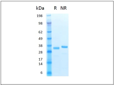 The protein was resolved by SDS-polyacrylamide  gel electrophoresis and the gel was stained with Coomassie blue..