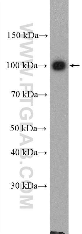 Western Blot (WB) analysis of HEK-293 cells using Adaptin Polyclonal antibody (10130-1-AP)