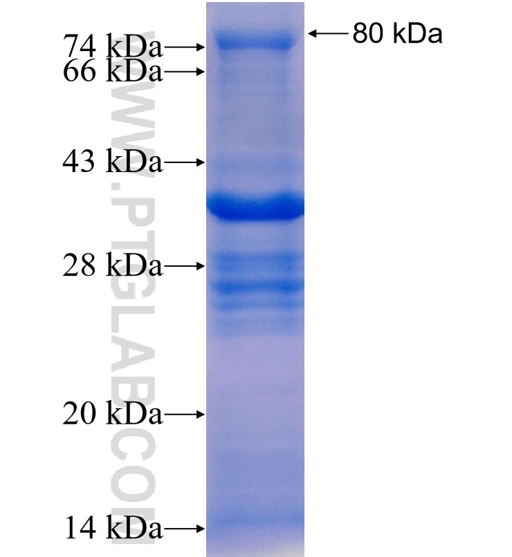 rat-adaptin fusion protein Ag0011 SDS-PAGE