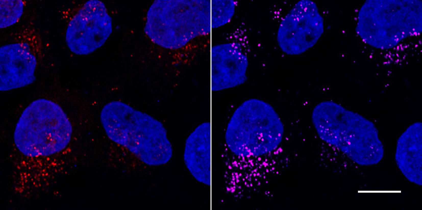 Confocal images of HeLa cells transiently transfected with LC3B-mCherry (red) and immunostained with RFP-Booster Alexa Fluor647 (magenta). Nuclei were stained with DAPI (blue). Scale bar, 10 μm. Images were recorded at the Core Facility Bioimaging at the Biomedical Center, LMU Munich.