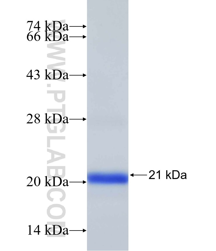rpeB fusion protein Ag31848 SDS-PAGE