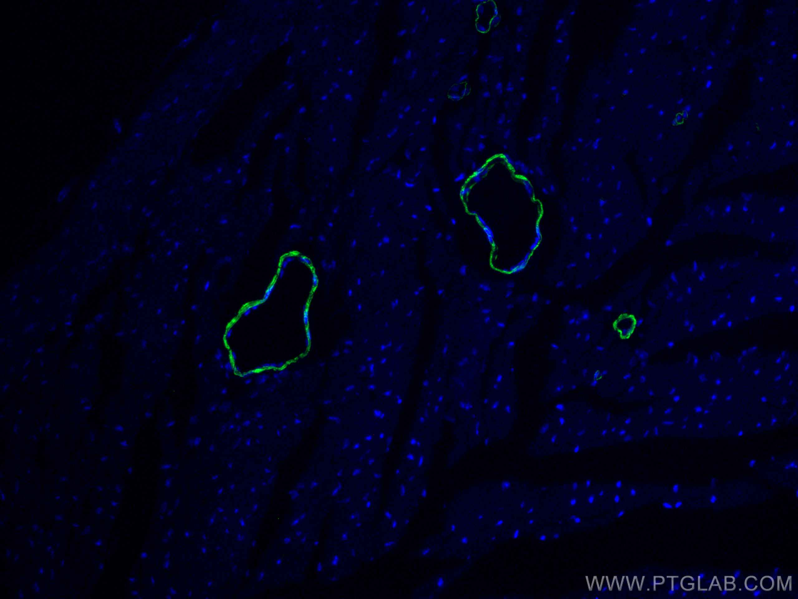 Immunofluorescence (IF) / fluorescent staining of mouse heart tissue using CoraLite® Plus 488-conjugated smooth muscle actin  (CL488-14395)