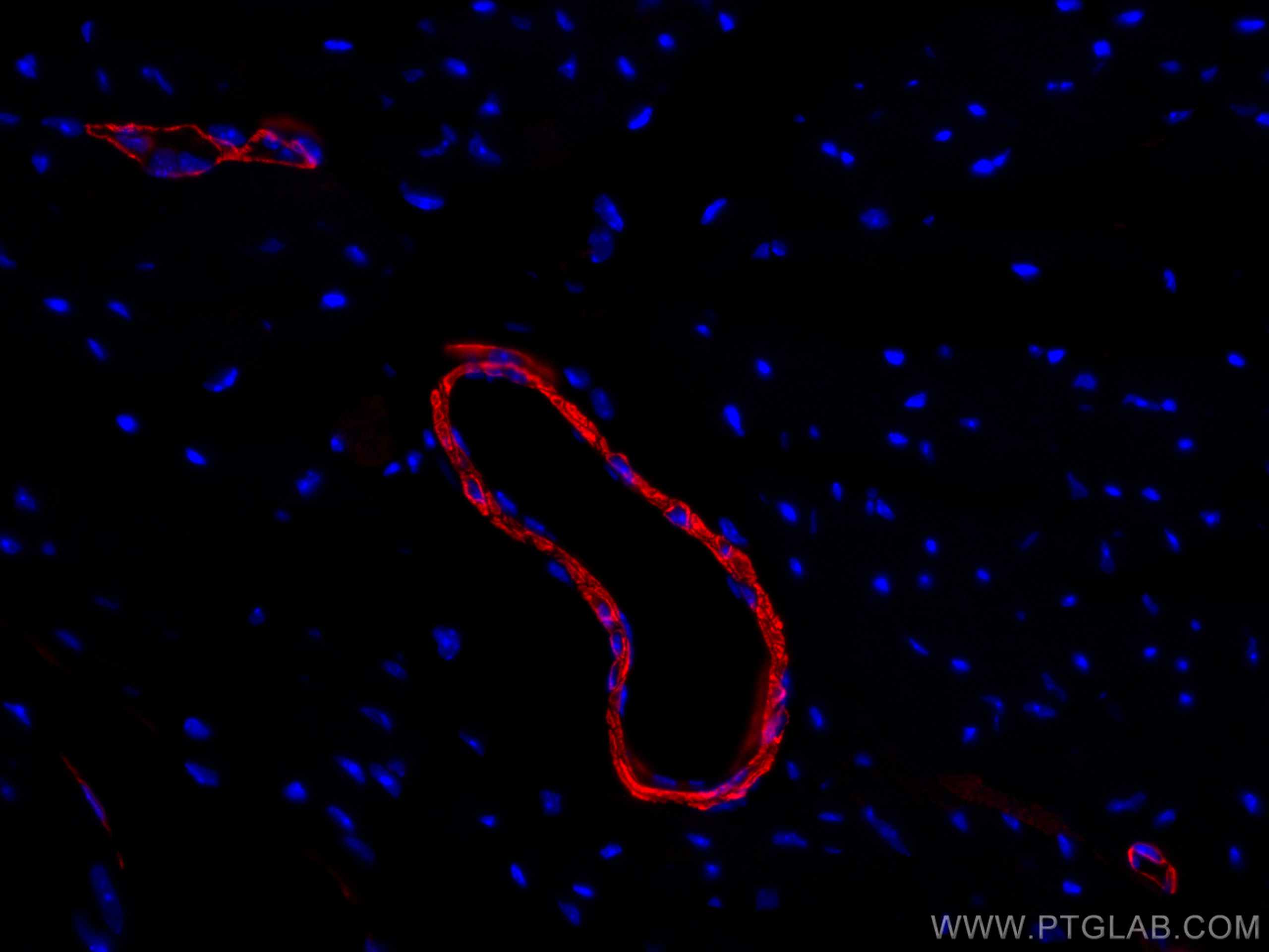 Immunofluorescence (IF) / fluorescent staining of mouse heart tissue using CoraLite®594-conjugated smooth muscle actin Polycl (CL594-14395)