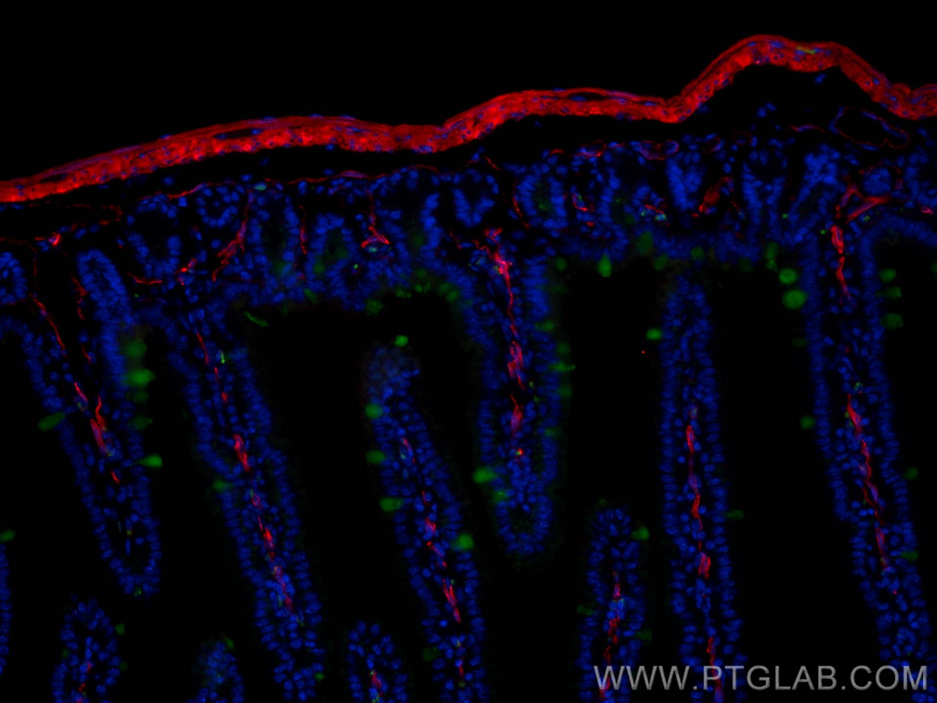 Immunofluorescence (IF) / fluorescent staining of mouse small intestine tissue using CoraLite®594-conjugated smooth muscle actin Polycl (CL594-14395)