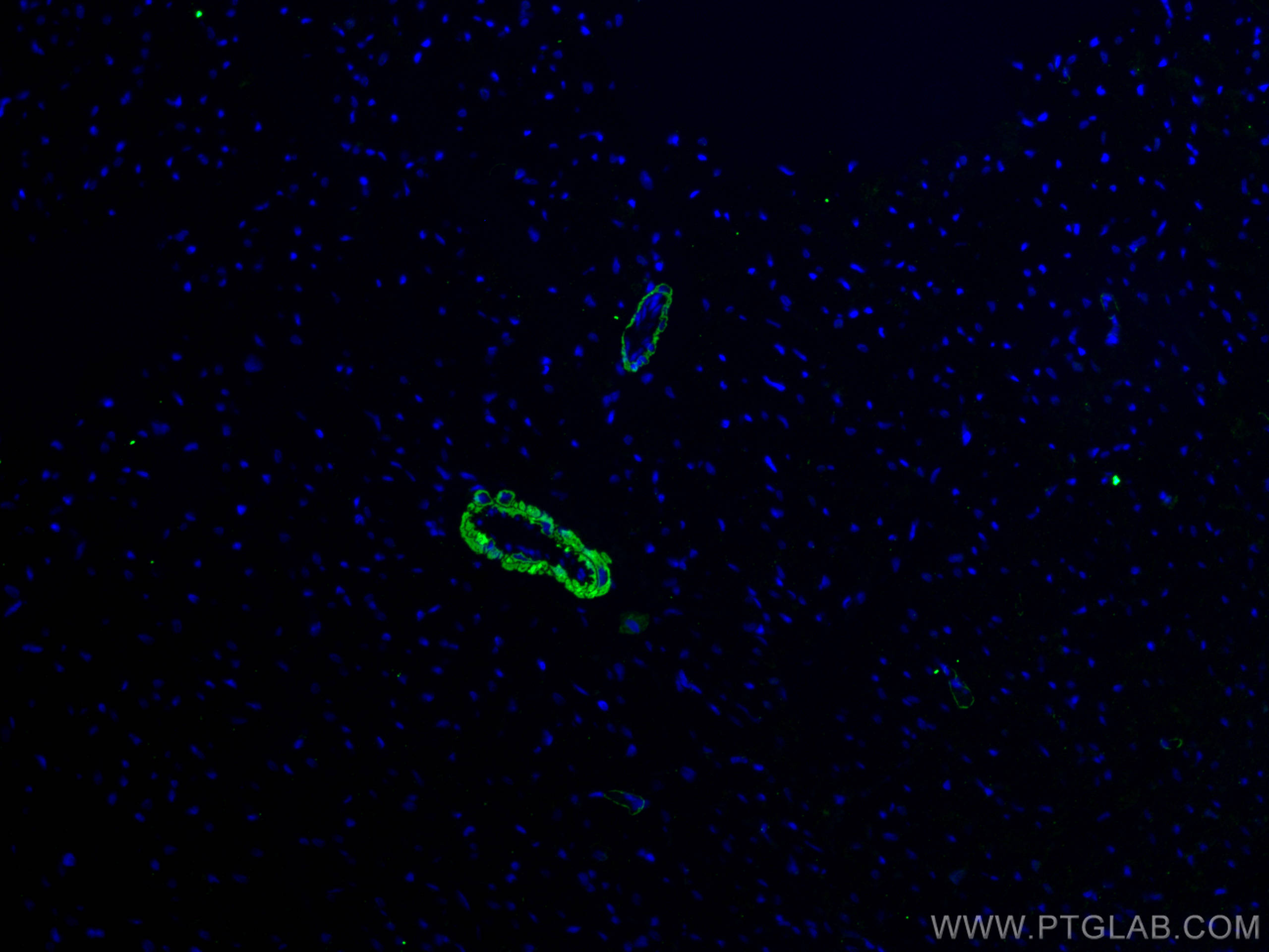 Immunofluorescence (IF) / fluorescent staining of rat heart tissue using smooth muscle actin specific Monoclonal antibody (67735-1-Ig)