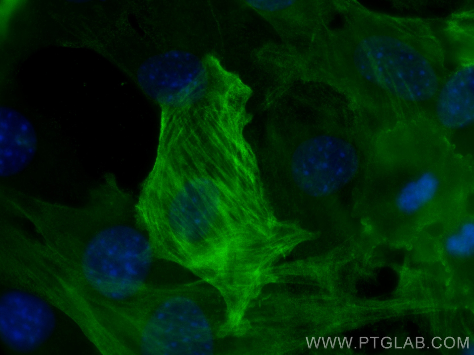 Immunofluorescence (IF) / fluorescent staining of C2C12 cells using smooth muscle actin specific Monoclonal antibody (67735-1-Ig)