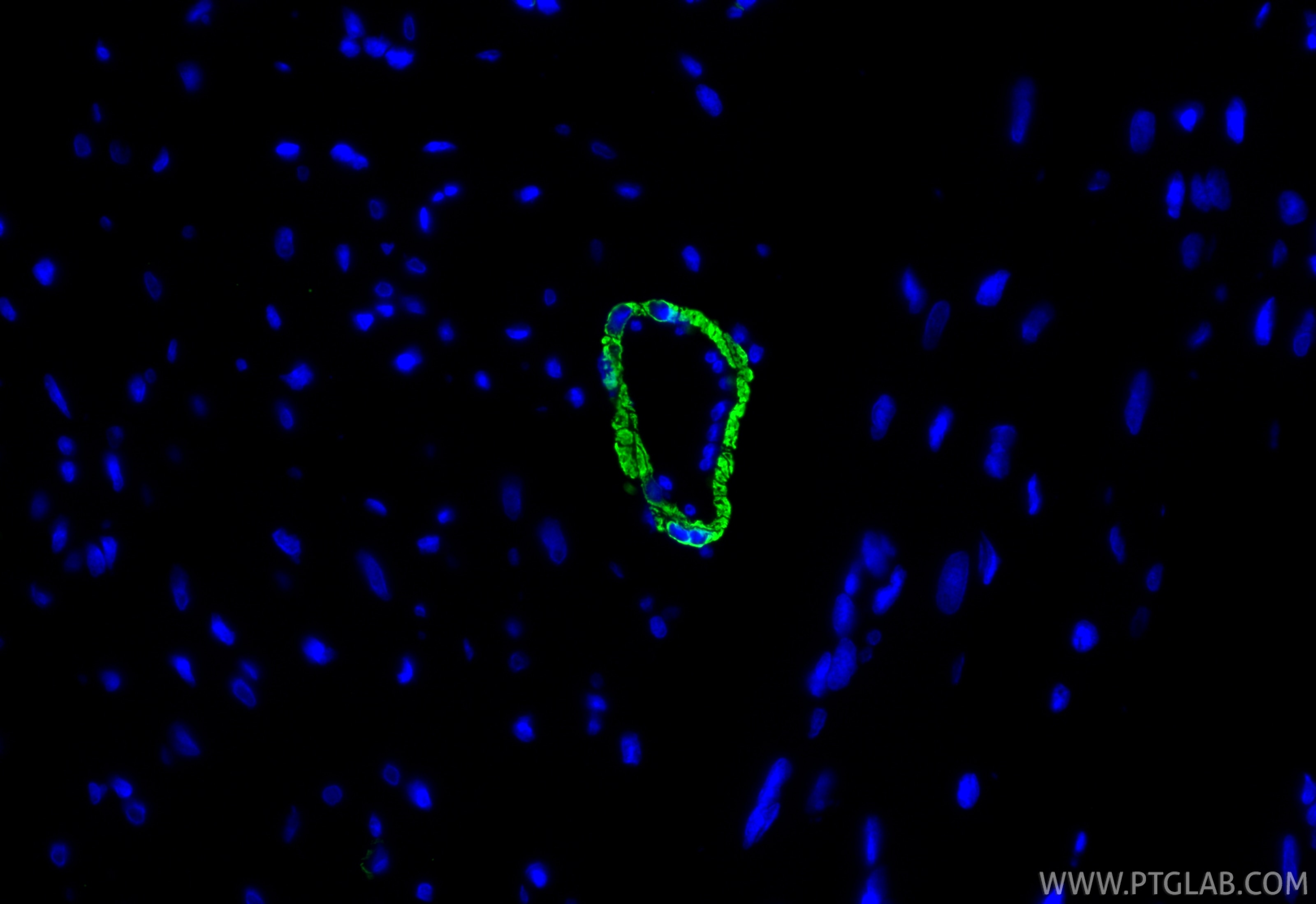 IF Staining of rat heart using 67735-1-Ig Immunofluorescence (IF) / fluorescent staining of rat heart tissue using Alpha smooth muscle actin specific Monoclonal anti (67735-1-Ig)
