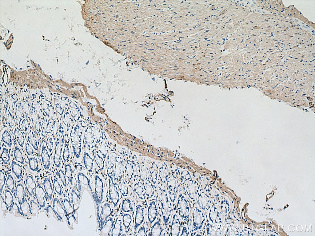 IHC staining of rat colon using 67735-1-Ig