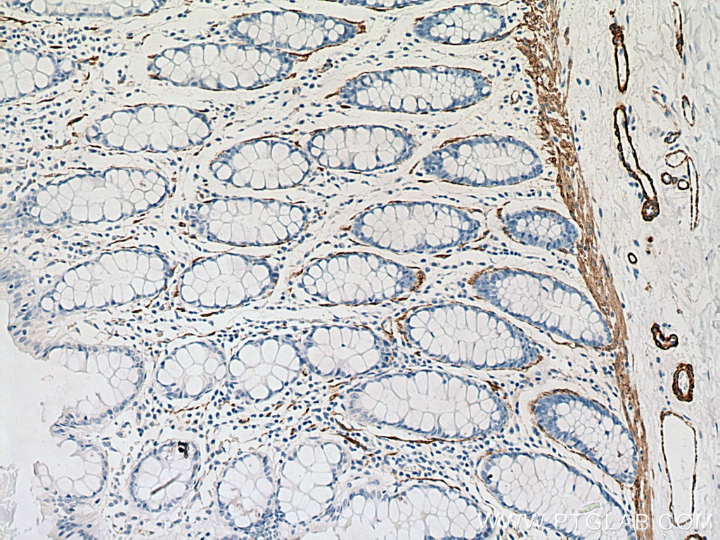 Immunohistochemistry (IHC) staining of human colon tissue using smooth muscle actin specific Monoclonal antibody (67735-1-Ig)