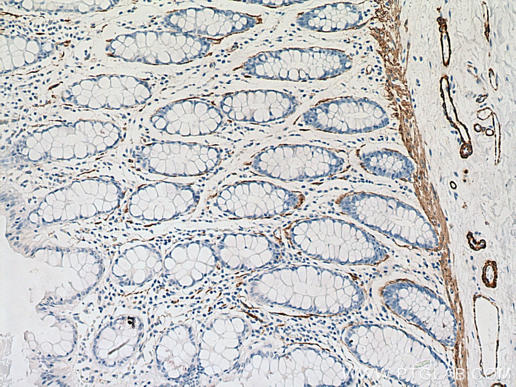 IHC staining of human colon using 67735-1-Ig