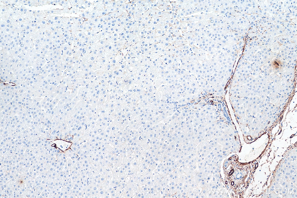 Immunohistochemistry (IHC) staining of human liver tissue using smooth muscle actin specific Monoclonal antibody (67735-1-Ig)
