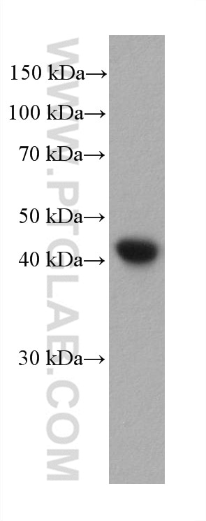 Western Blot (WB) analysis of pig vein tissue using smooth muscle actin specific Monoclonal antibody (67735-1-Ig)