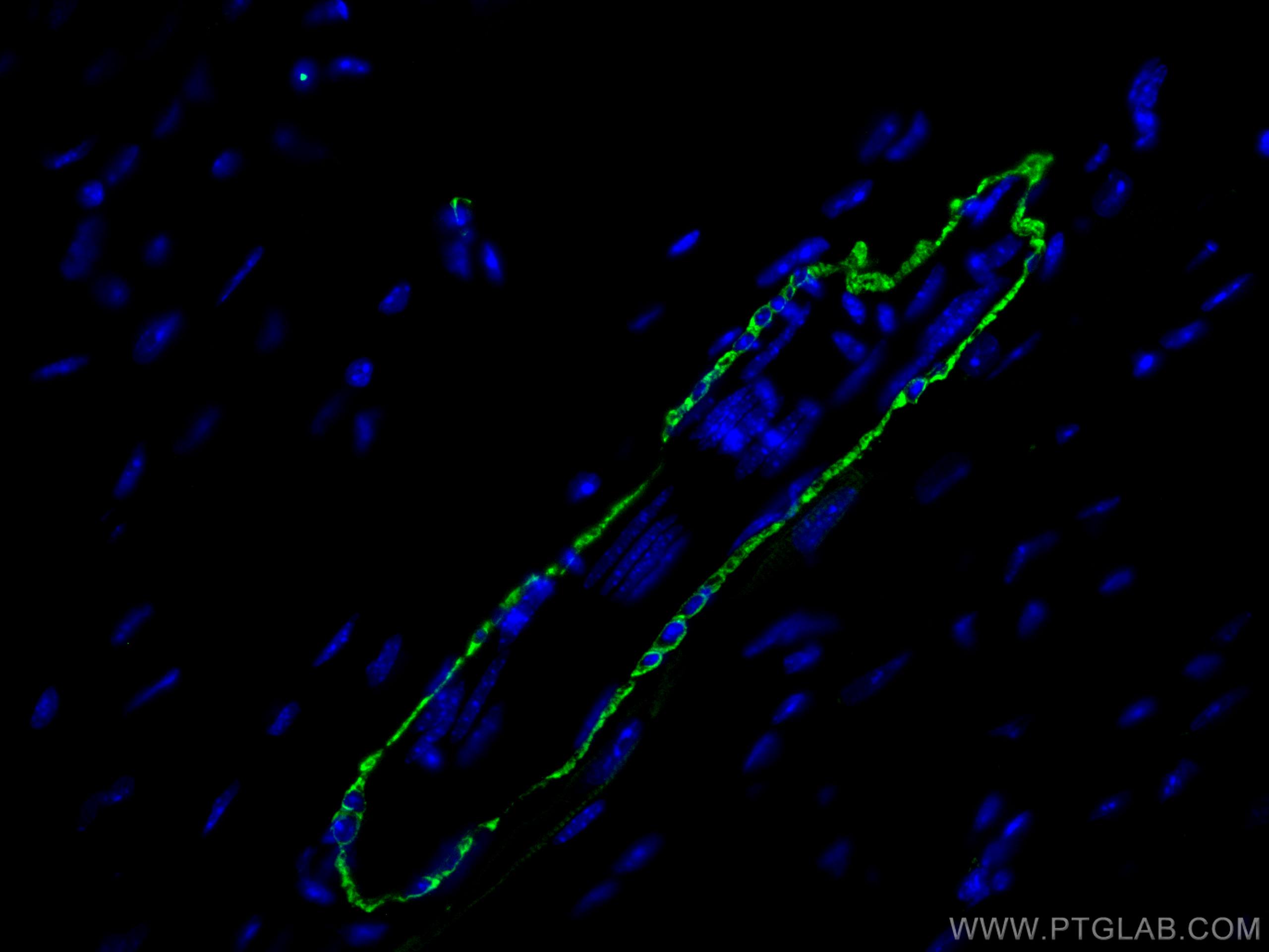 Immunofluorescence (IF) / fluorescent staining of mouse heart tissue using CoraLite® Plus 488-conjugated smooth muscle actin  (CL488-55135)