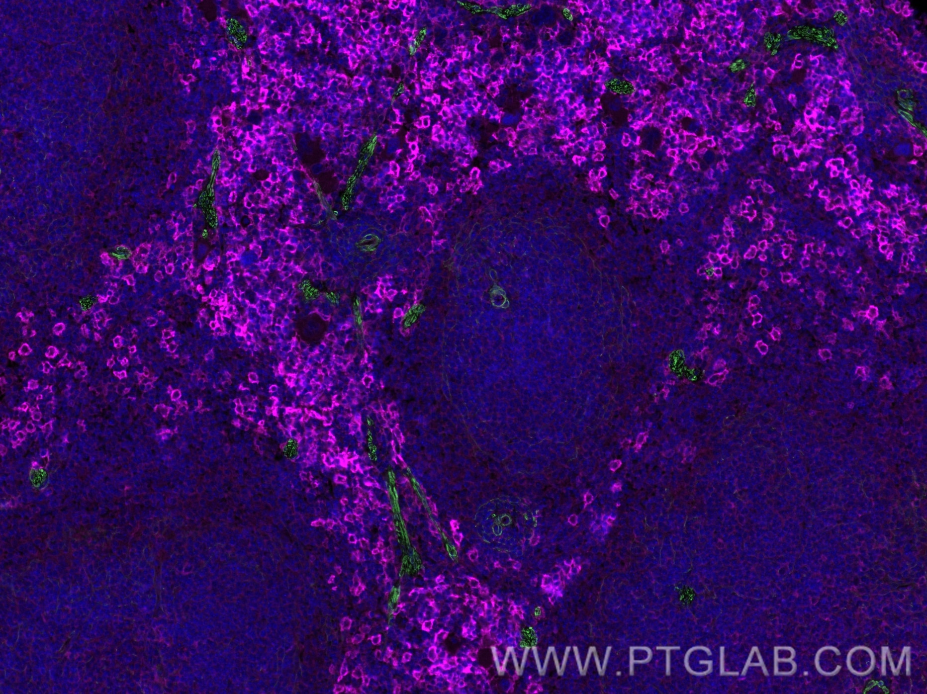 Immunofluorescence (IF) / fluorescent staining of mouse spleen tissue using CoraLite® Plus 488-conjugated smooth muscle actin  (CL488-55135)