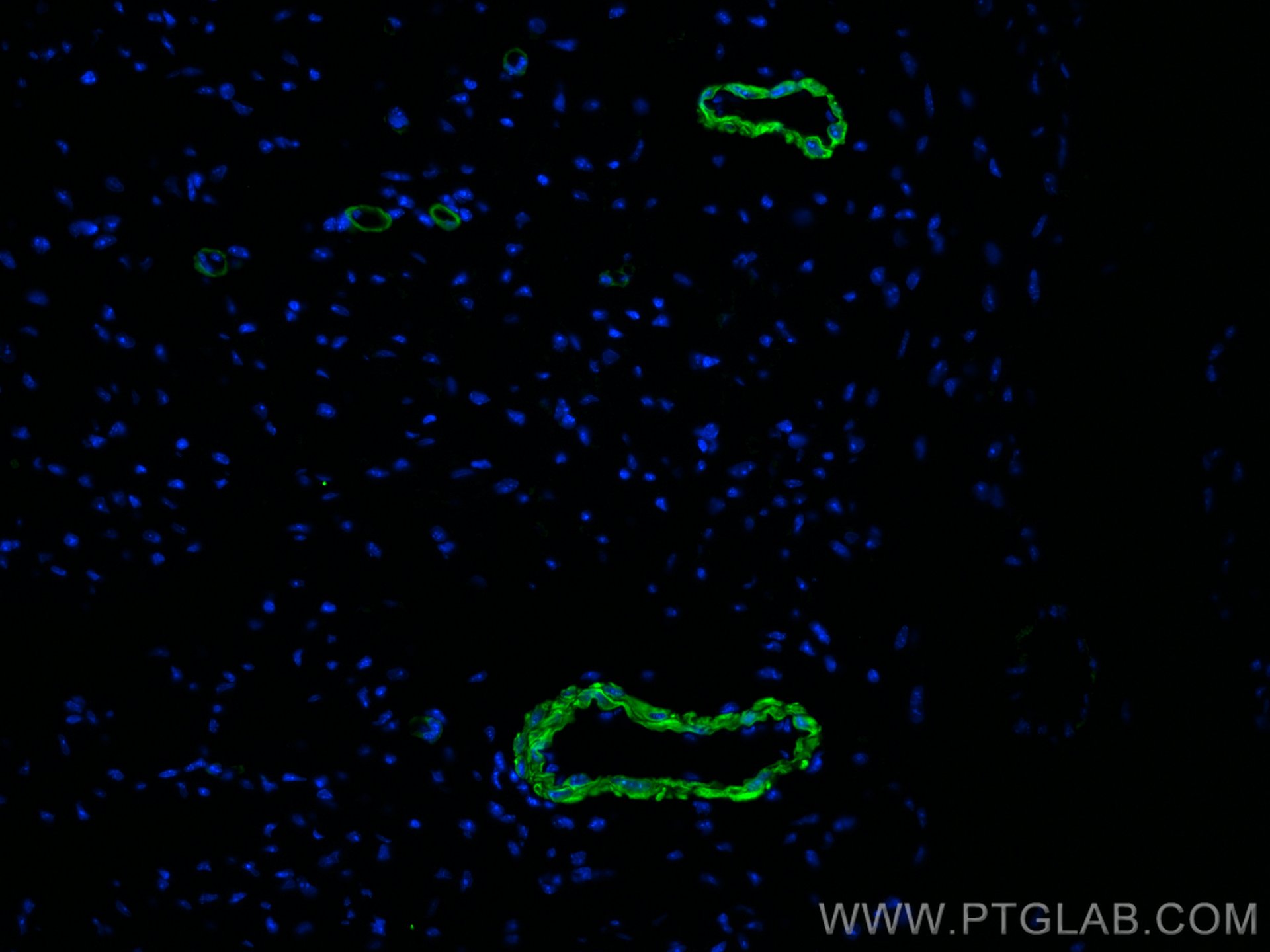 Immunofluorescence (IF) / fluorescent staining of mouse heart tissue using CoraLite® Plus 488-conjugated smooth muscle actin  (CL488-67735)