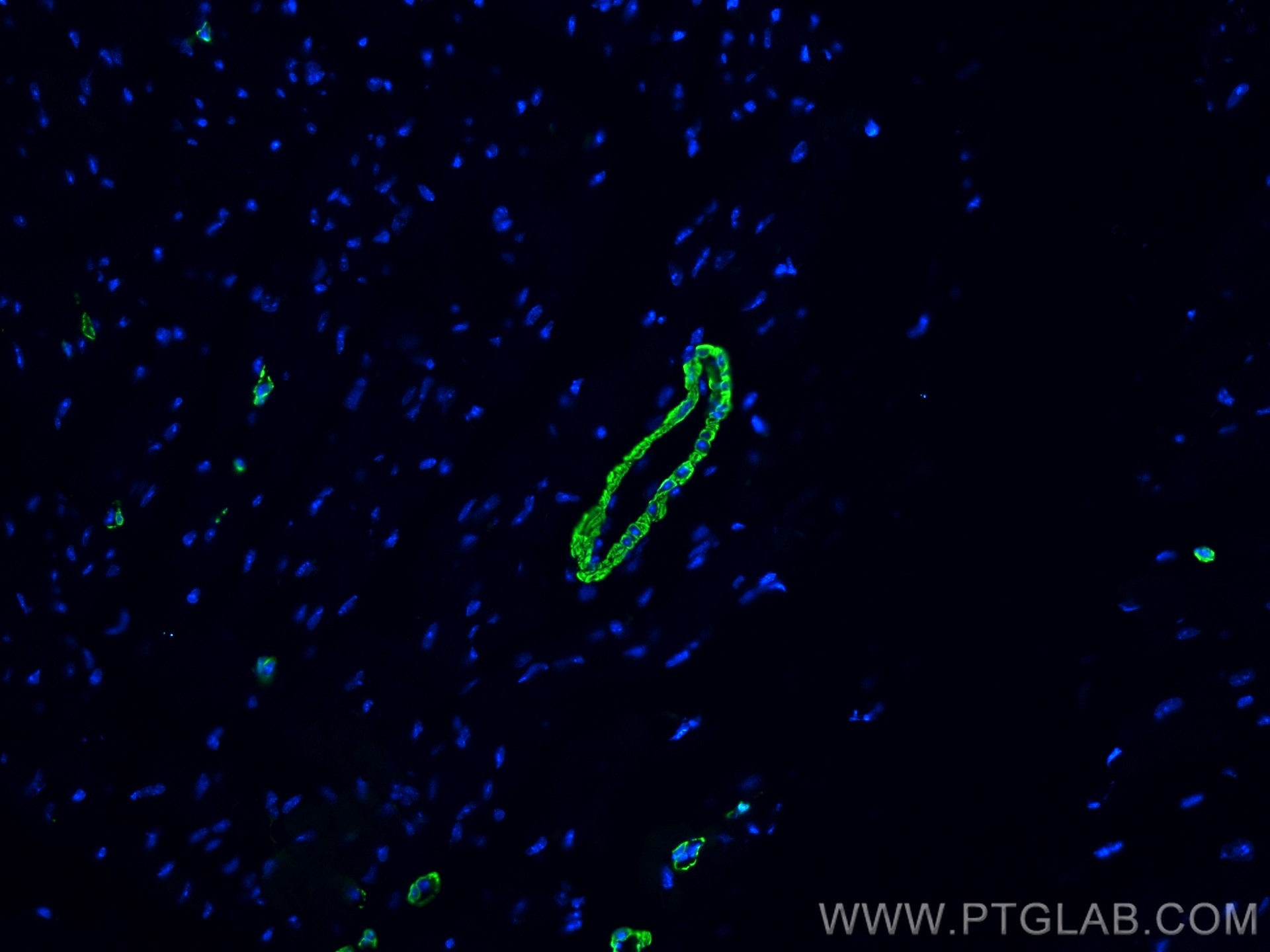 Immunofluorescence (IF) / fluorescent staining of mouse heart tissue using CoraLite® Plus 488-conjugated smooth muscle actin  (CL488-80008)