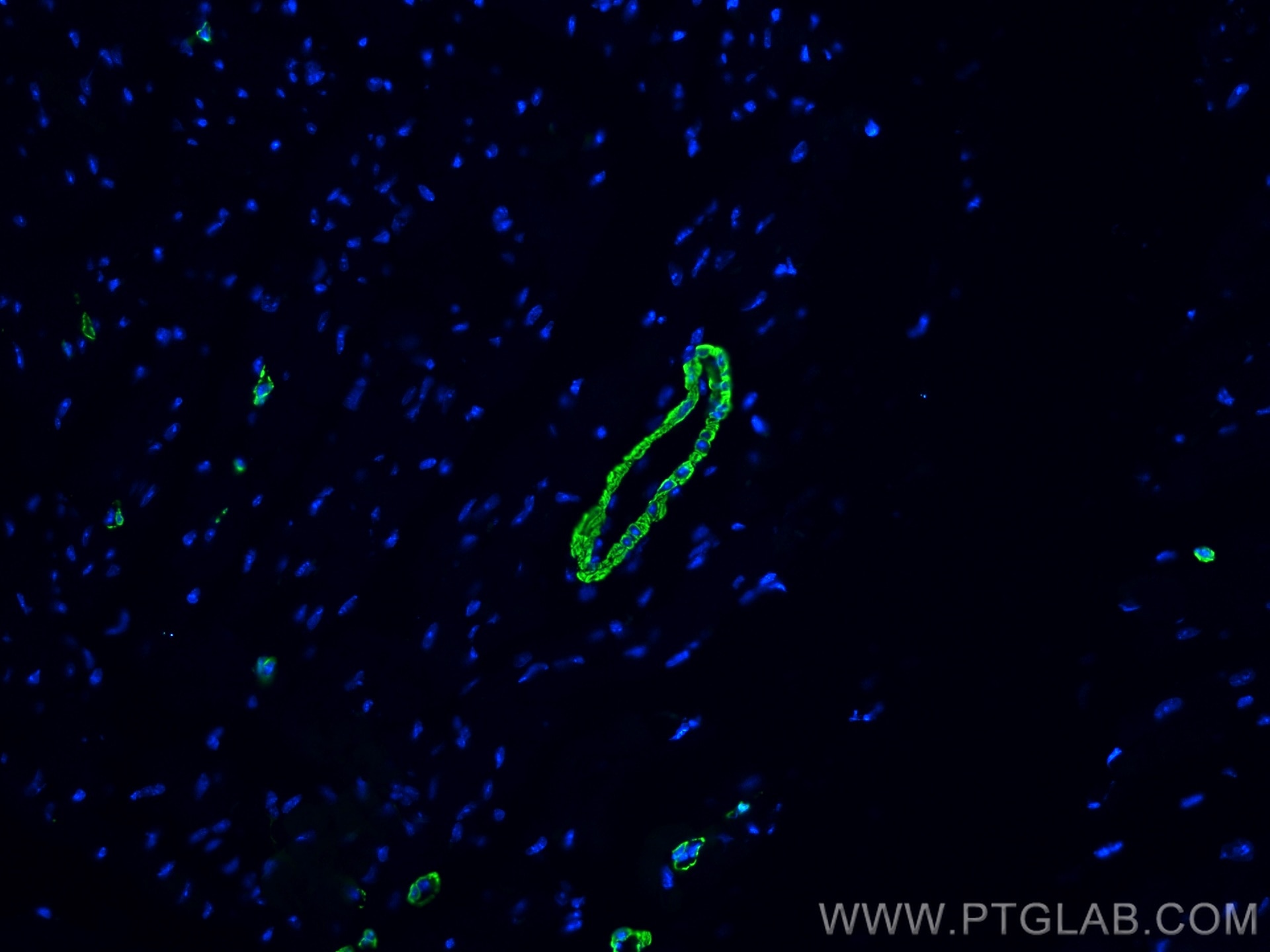 IF Staining of mouse heart using CL488-80008