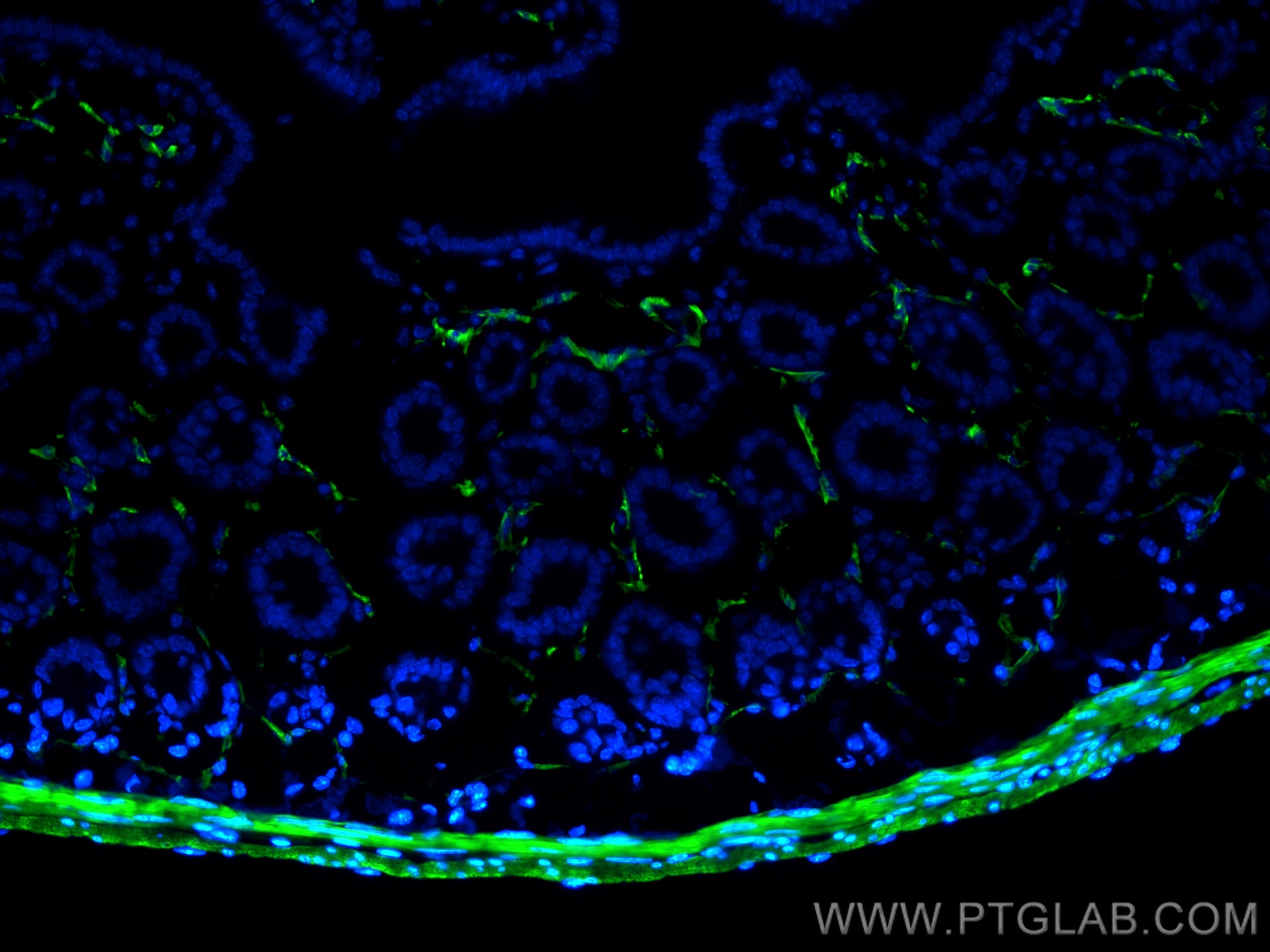 Immunofluorescence (IF) / fluorescent staining of mouse small intestine tissue using CoraLite® Plus 488-conjugated Alpha smooth muscle  (CL488-80008)