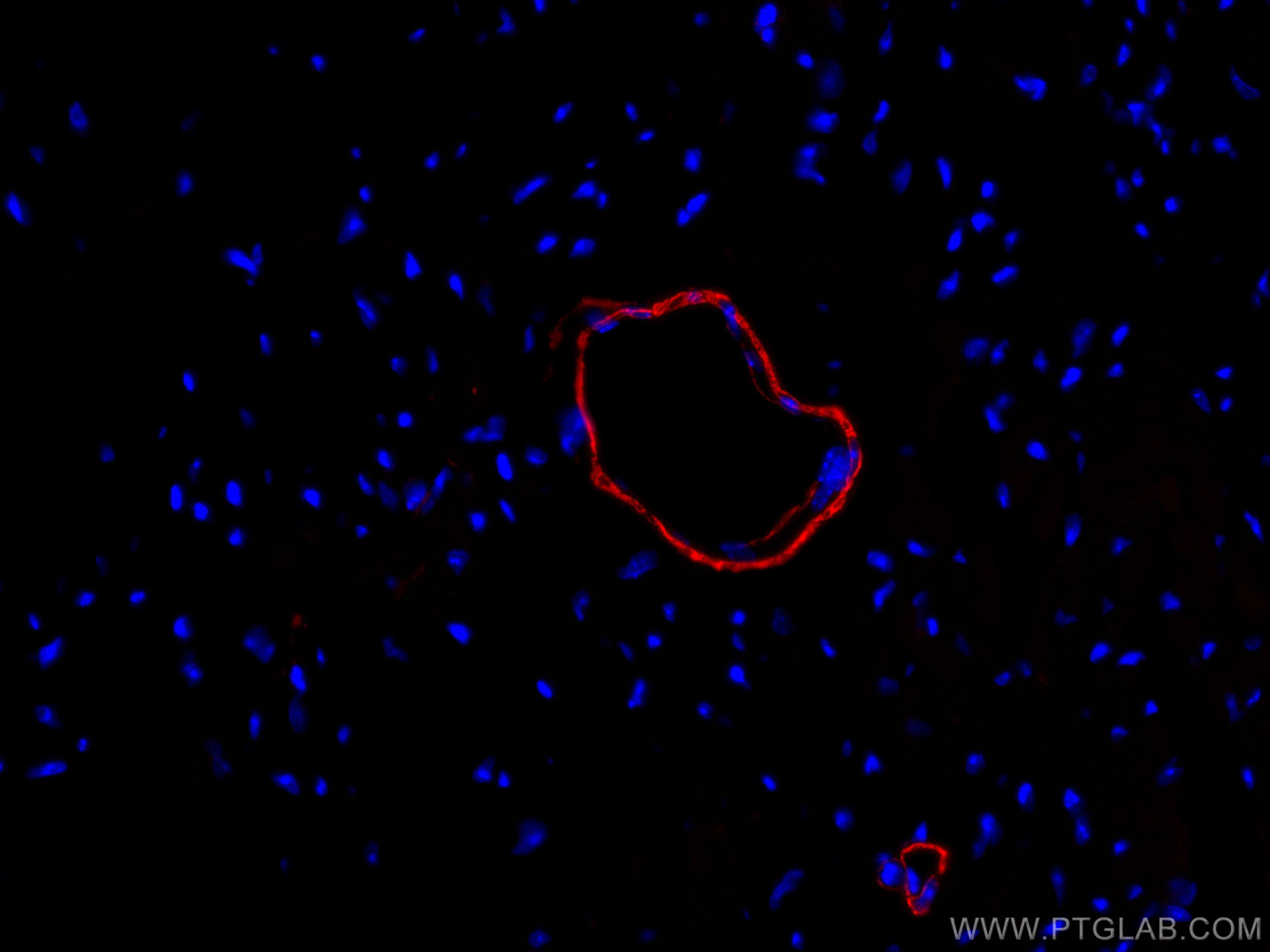 IF Staining of mouse heart using CL594-55135