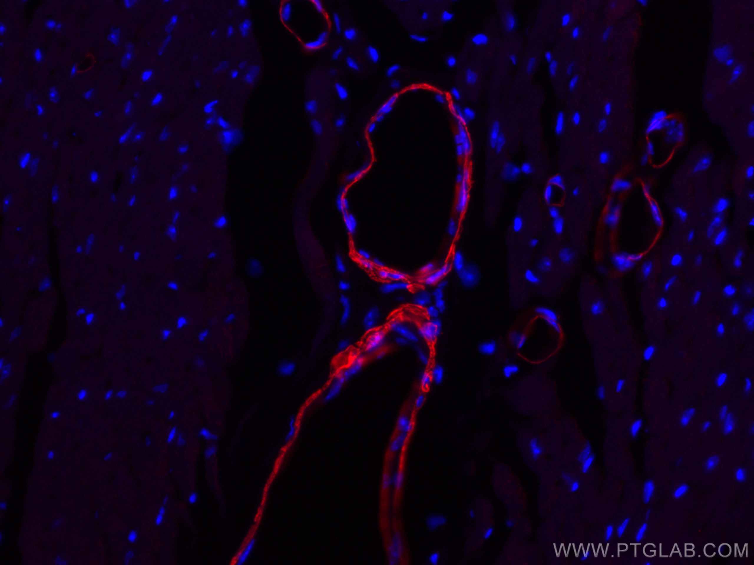 Immunofluorescence (IF) / fluorescent staining of mouse heart tissue using CoraLite®594-conjugated smooth muscle actin specif (CL594-67735)