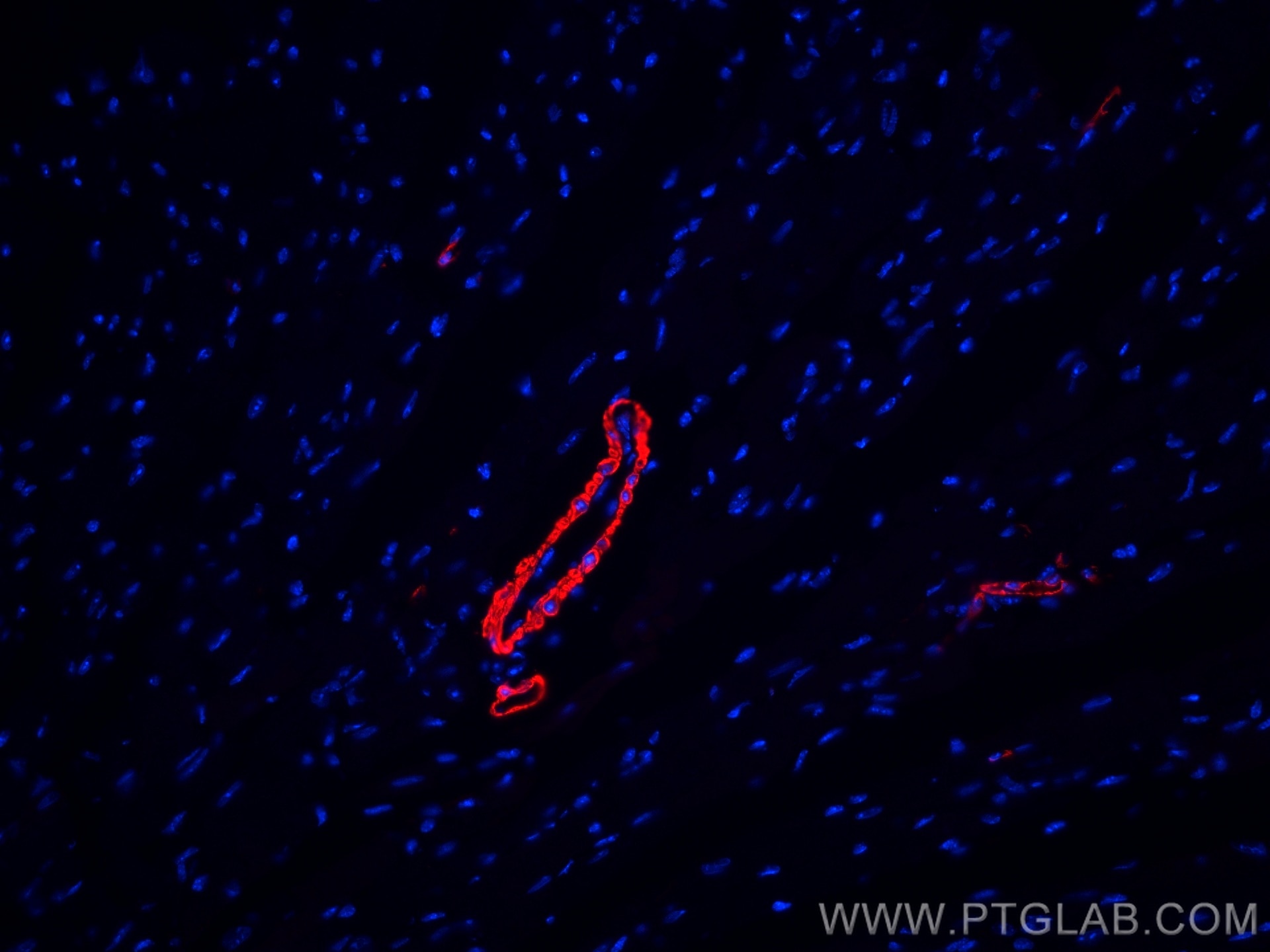 Immunofluorescence (IF) / fluorescent staining of mouse heart tissue using CoraLite®594-conjugated smooth muscle actin specif (CL594-80008)