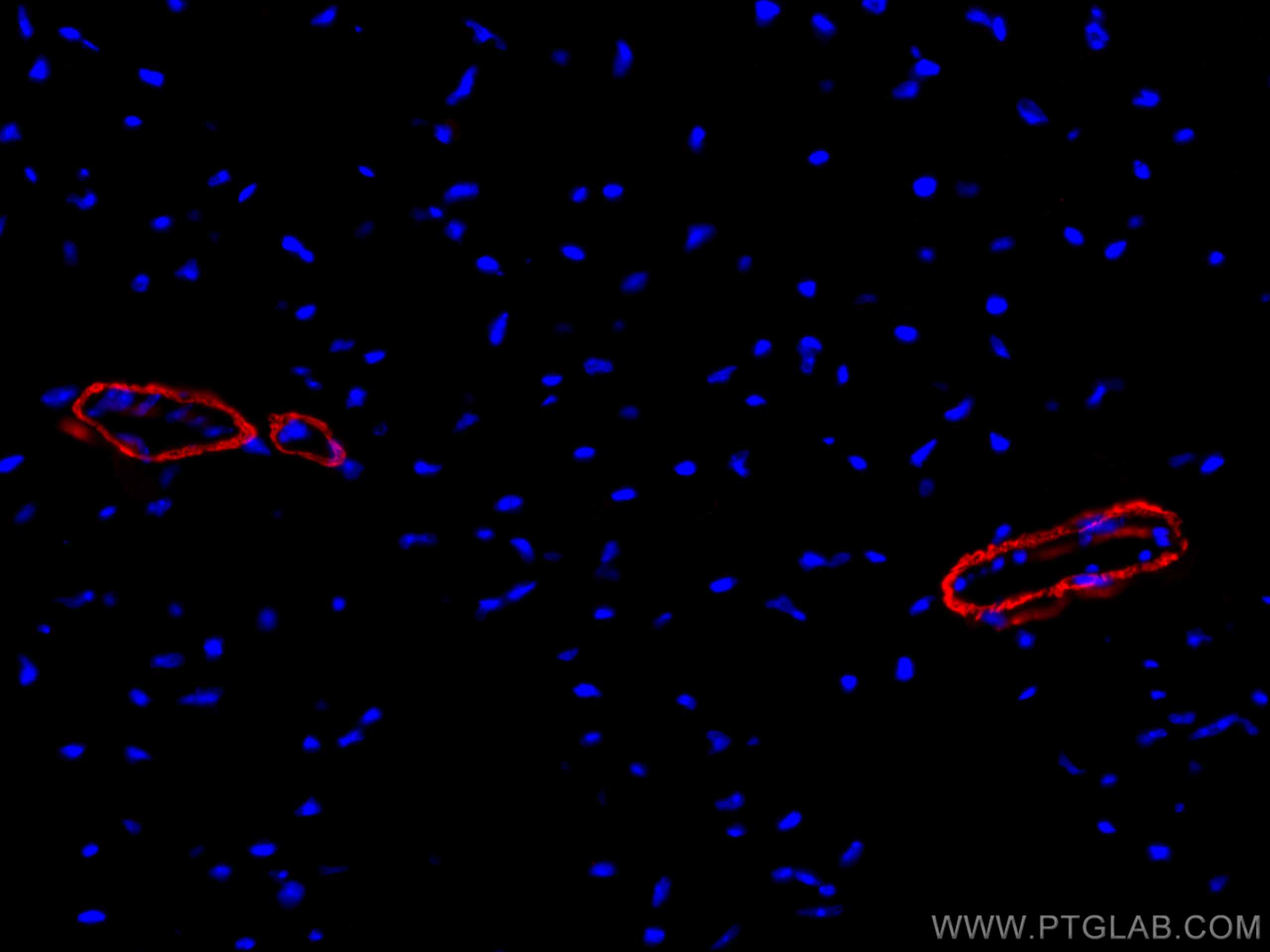 smooth muscle actin specific