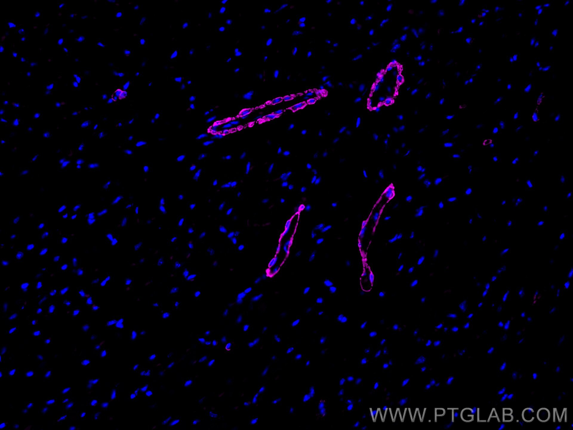 Immunofluorescence (IF) / fluorescent staining of mouse heart tissue using CoraLite® Plus 647-conjugated smooth muscle actin  (CL647-67735)