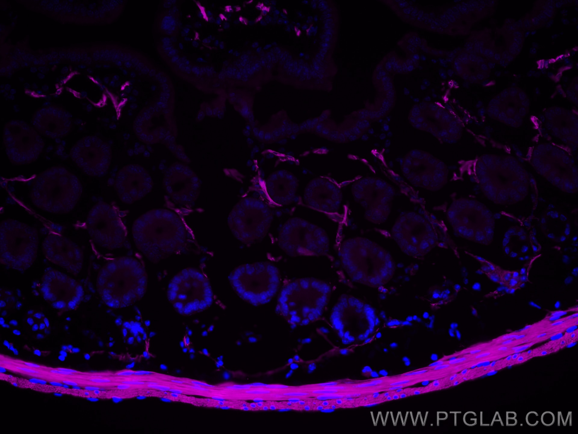 Immunofluorescence (IF) / fluorescent staining of mouse small intestine tissue using CoraLite® Plus 647-conjugated Alpha smooth muscle  (CL647-80008)