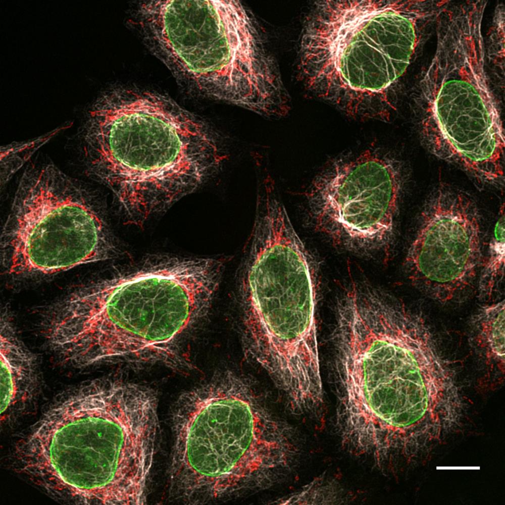 The anti-mouse IgG1 Nano-Secondary is subclass-specific and does not cross-react with IgGs from other commonly used species (here rabbit) and with mouse IgG2b and IgG3 subclasses.