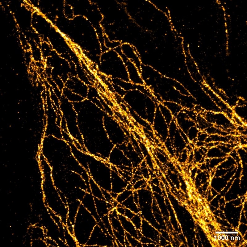 Vimentin in HeLa cells: The cells were stained with monoclonal anti-Vimentin mouse IgG1 antibody and alpaca anti-mouse IgG1 VHH Alexa Fluor® 488 and recorded with Leica GSDIM system. The image is a courtesy of Dr. Leila Nahidiazar, Dr. Jop Kind, and Prof. Kees Jalink.