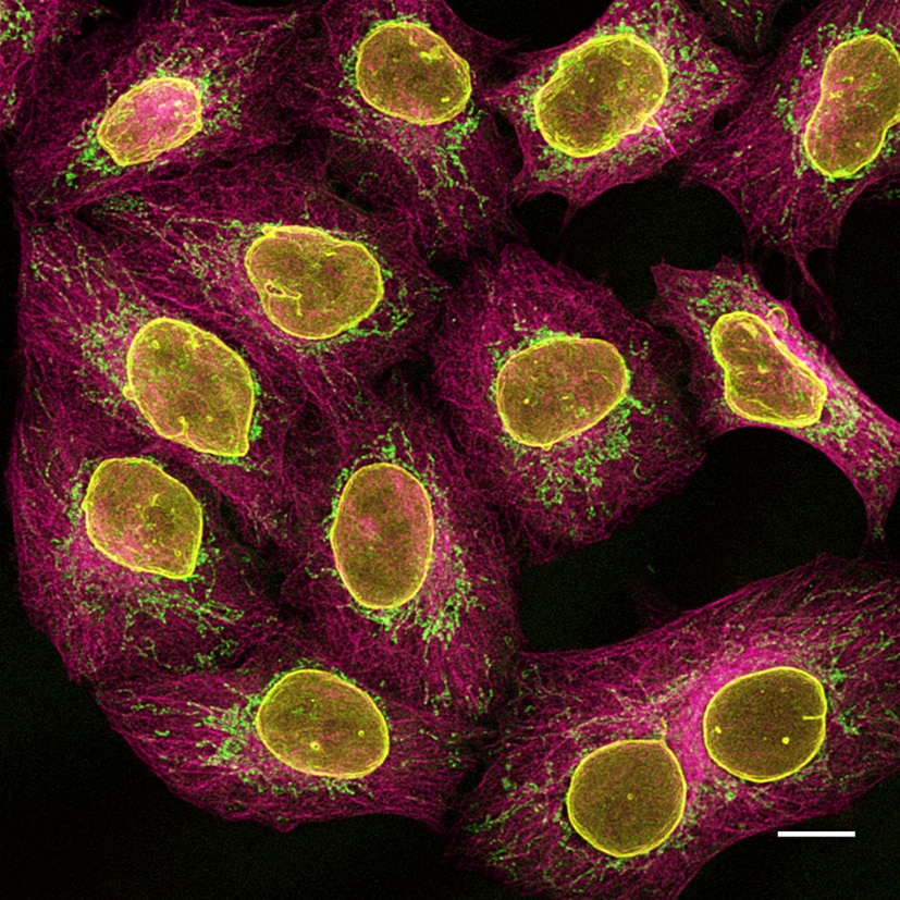 Multiplexed immunostaining of HeLa cells with two alpaca anti-mouse Nano-Secondaries and one anti-rabbit Nano-Secondary. Green: mouse IgG1 anti-COX4 + alpaca anti-mouse IgG1 VHH Alexa Fluor 488. Magenta: mouse IgG2b anti-Tubulin + alpaca anti-mouse IgG2b VHH Alexa Fluor 647. Yellow: rabbit anti-Lamin + alpaca anti-rabbit IgG VHH Alexa Fluor 568. Scale bar, 10 μm.