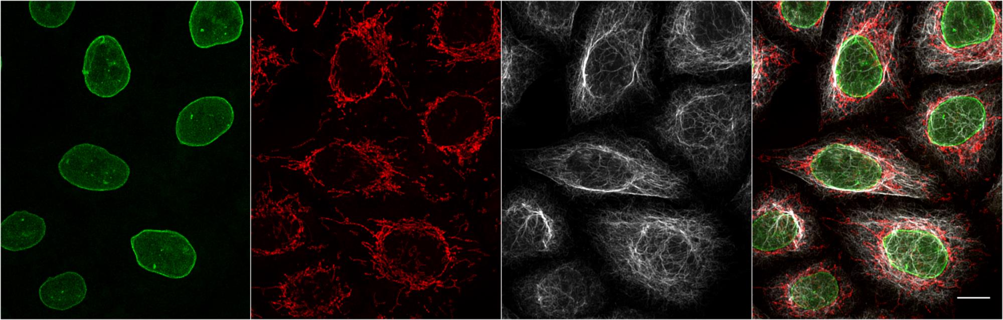 Multiplexed immunostaining of HeLa cells with 3 subclass-specific alpaca anti-mouse Nano-Secondaries. Grey: Mouse IgG1 anti-Vimentin + alpaca anti-mouse IgG1 VHH Alexa Fluor® 647. Green: Mouse IgG2b anti-Lamin + alpaca anti-mouse IgG2b VHH Alexa Fluor® 488. Red: Mouse IgG3 anti-MOT + alpaca anti-mouse IgG3 VHH Alexa Fluor® 568. Scale bar, 10 μm. Images were recorded at the Core Facility Bioimaging at the Biomedical Center, LMU Munich.