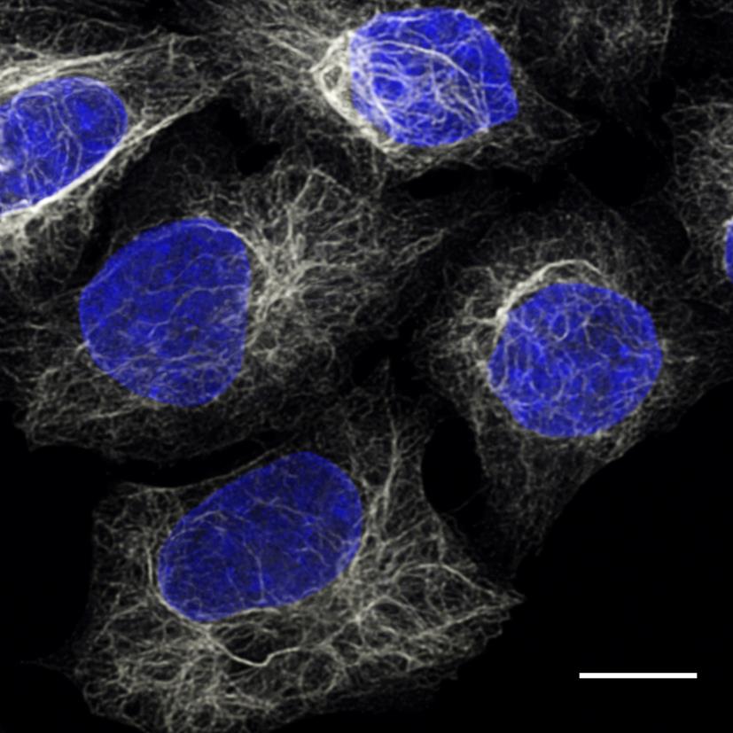 HeLa cells were immunostained with anti-Vimentin mouse IgG1 antibody and alpaca anti-mouse IgG1 VHH Alexa Fluor® 647 (grey). Nuclei were stained with DAPI, blue. Scale bar, 10 μm. Images were recorded at the Core Facility Bioimaging at the Biomedical Center, LMU Munich.