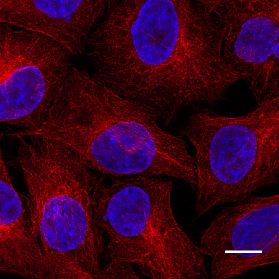 HeLa cells were immunostained with mouse IgG2b anti-βTubulin antibody + alpaca anti-mouse IgG2b VHH Alexa Fluor® 568 (red). Nuclei were stained with DAPI (blue). Scale bar, 10 μm. Images were recorded at the Core Facility Bioimaging at the Biomedical Center, LMU Munich