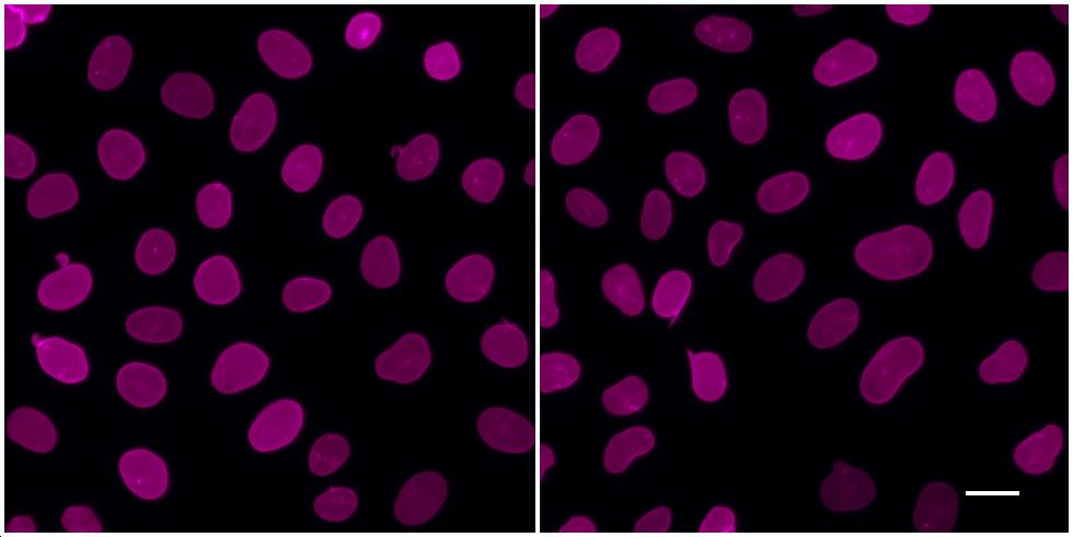 One-step staining (left) vs. sequential staining (right) of HeLa cells with anti-Lamin A/C (nuclear lamina) mouse IgG2b monoclonal primary antibody + alpaca anti-mouse IgG2b VHH Alexa Fluor® 647 (magenta). Scale bar, 20 μm.