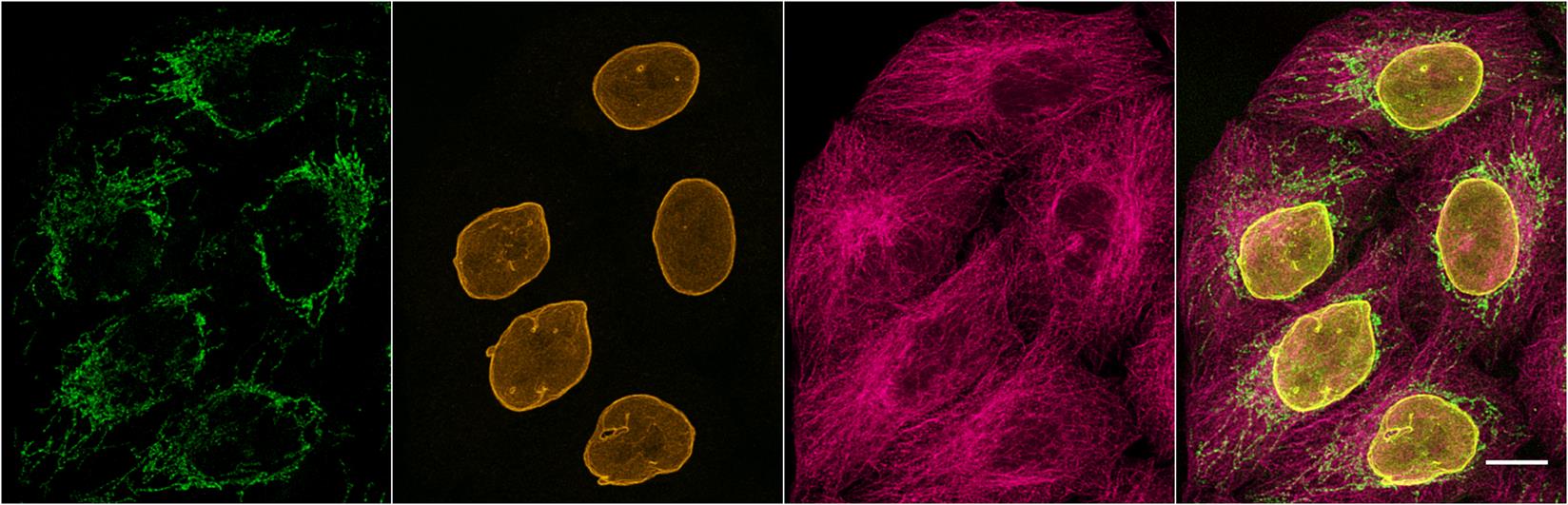 Multiplexed immunostaining of HeLa cells with two alpaca anti-mouse Nano-Secondaries and one anti-rabbit Nano-Secondary. Green: mouse IgG1 anti-COX4 + alpaca anti-mouse IgG1 VHH Alexa Fluor® 488. Yellow: rabbit anti-Lamin + alpaca anti-rabbit IgG VHH Alexa Fluor® 568. Magenta: mouse IgG2b anti-Tubulin + alpaca anti-mouse IgG2b VHH Alexa Fluor® 647. Scale bar, 10 μm. Images were recorded at the Core Facility Bioimaging at the Biomedical Center, LMU Munich.