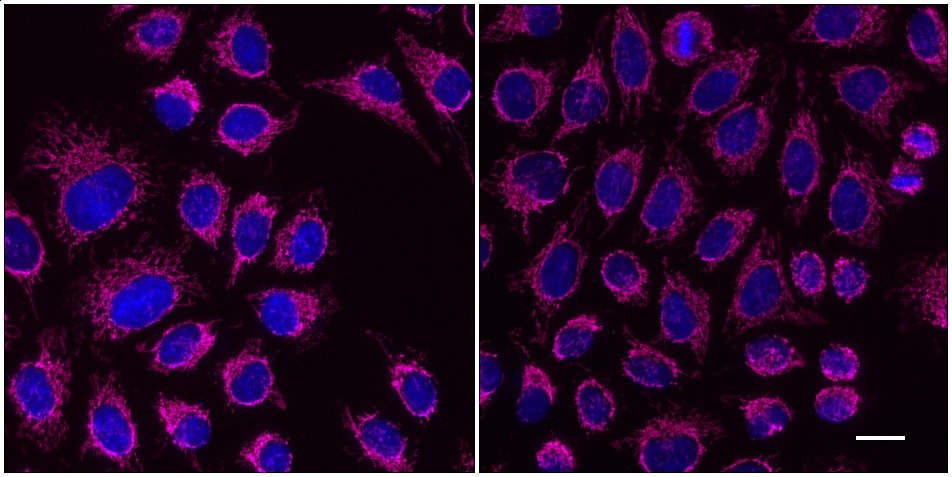 One-step staining (left) vs. sequential staining (right) of HeLa cells with anti-MOT (mitochondria) mouse IgG3 monoclonal primary antibody + alpaca anti-mouse IgG3 VHH Alexa Fluor® 647 (magenta). Cell nuclei are stained with DAPI (blue). Scale bar, 20 μm.