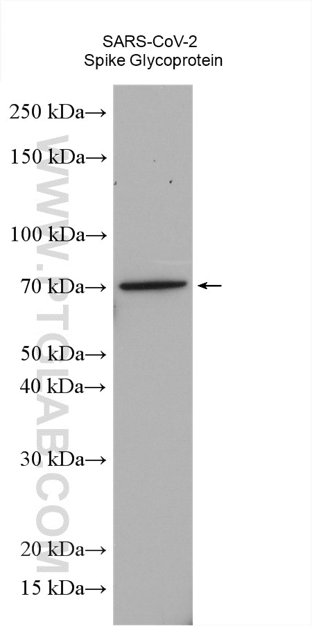 Western Blot (WB) analysis of various lysates using SARS-CoV-2 S protein (428-506 aa) Polyclonal antib (28901-1-AP)