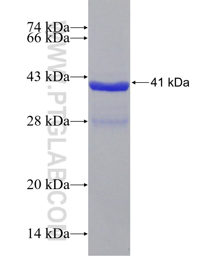 spike protein fusion protein Ag30679 SDS-PAGE