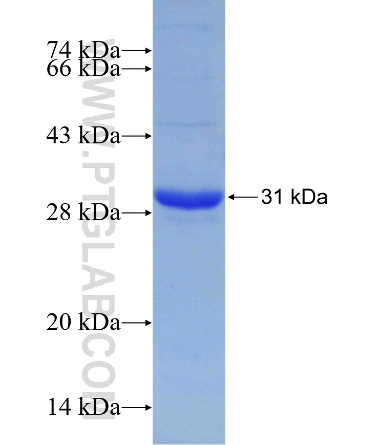 spike protein fusion protein Ag30682 SDS-PAGE