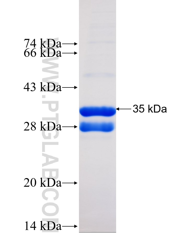 spike protein fusion protein Ag30684 SDS-PAGE