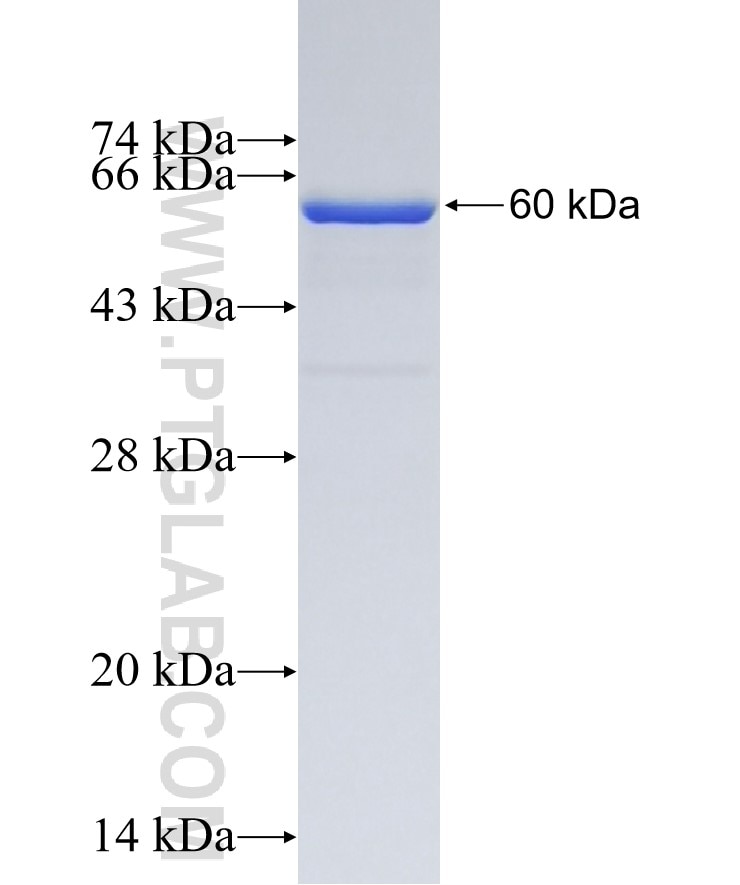 spike protein fusion protein Ag30685 SDS-PAGE