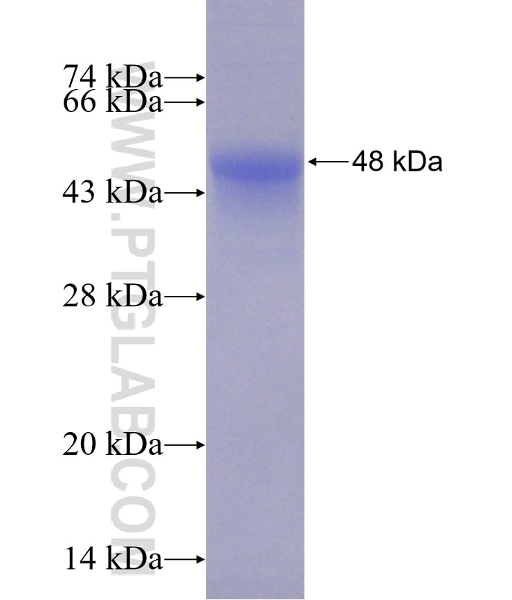 spike protein fusion protein Ag31496 SDS-PAGE
